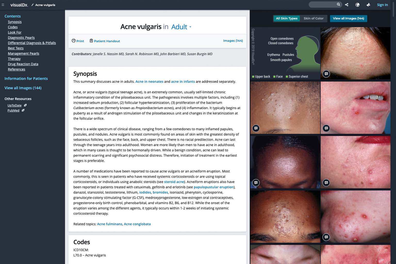 screenshot of search results for acne in VisualDx