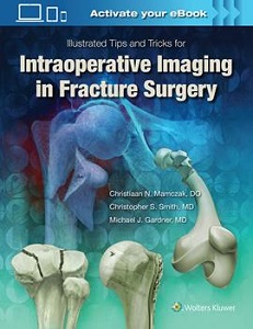 Illustrated Tips and Tricks for Intraoperative Imaging in Fracture Surgery book cover