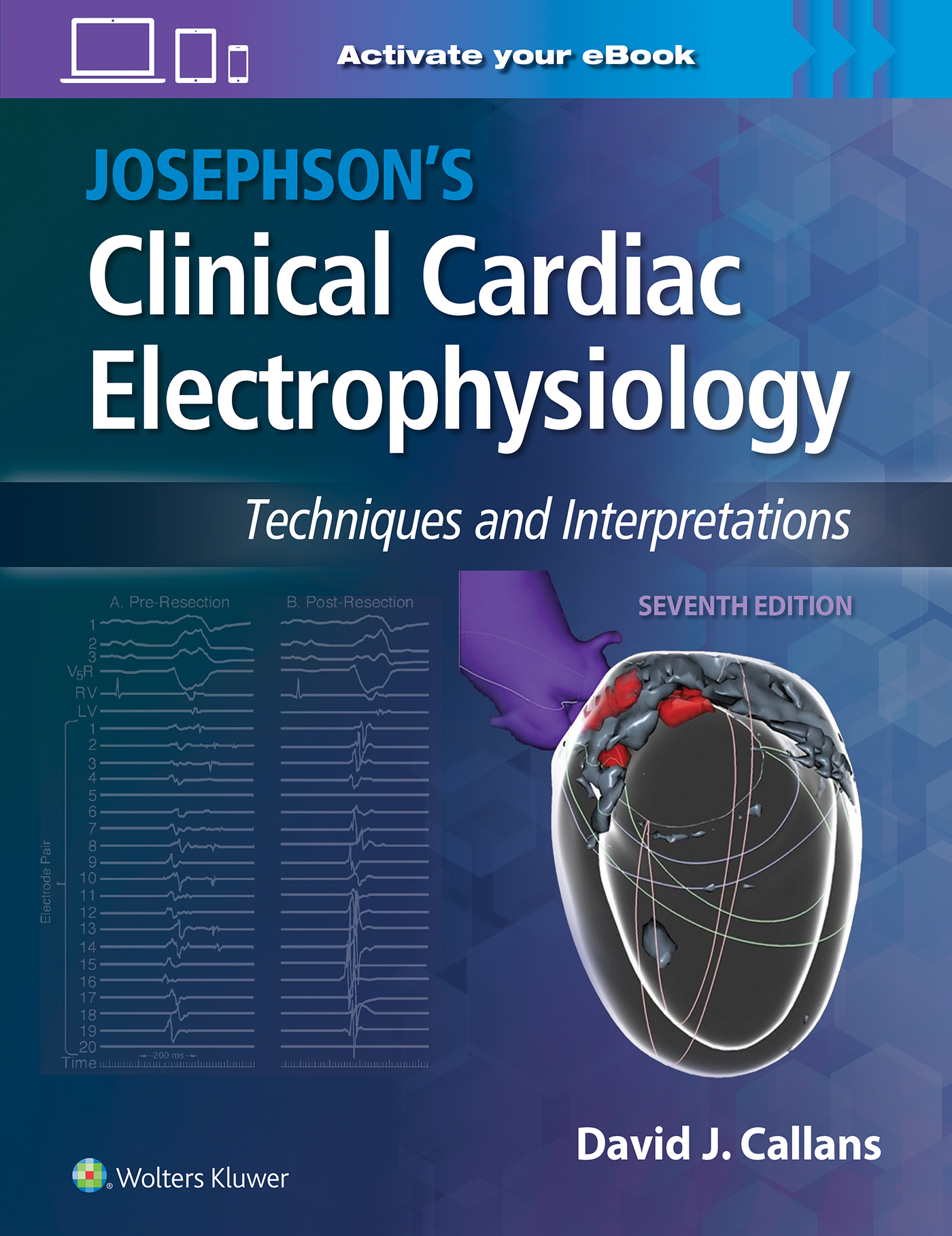 Josephson's Clinical Cardiac Electrophysiology