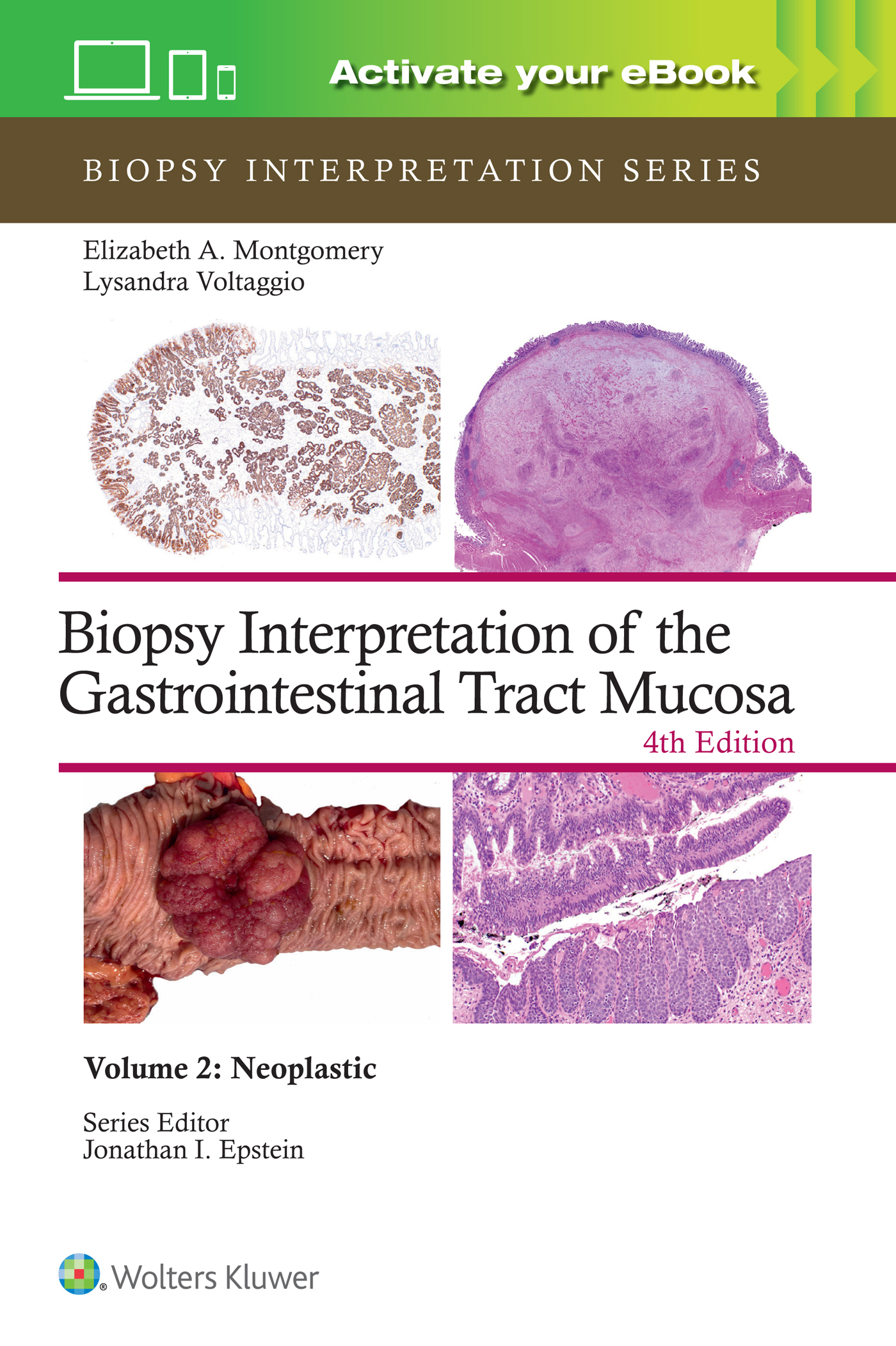 Biopsy Interpretation of the Gastrointestinal Tract Mucosa Volume 2 (Biopsy Interpretation Series)