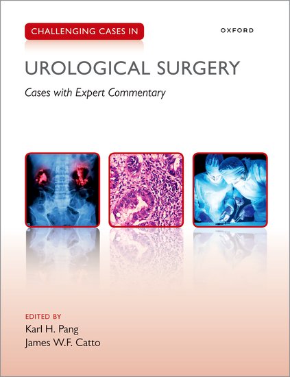 Challenging Cases in Urological Surgery, 1st Ed.