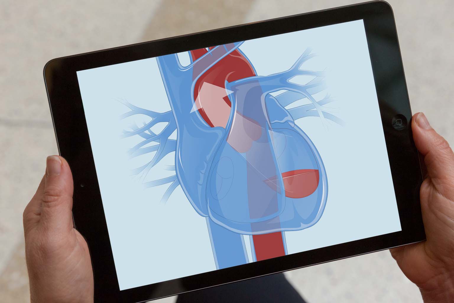 patient viewing heart illustration on a tablet