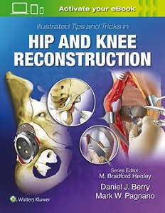Illustrated Tips and Tricks in Hip and Knee Reconstruction book cover