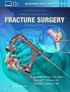 Harborview Illustrated Tips and Tricks in Fracture Surgery book cover