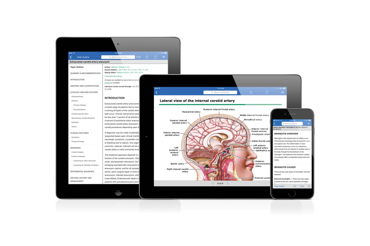 tablets and smartphone displaying UpToDate