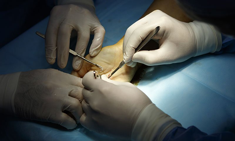 Surgeons operating on a hand