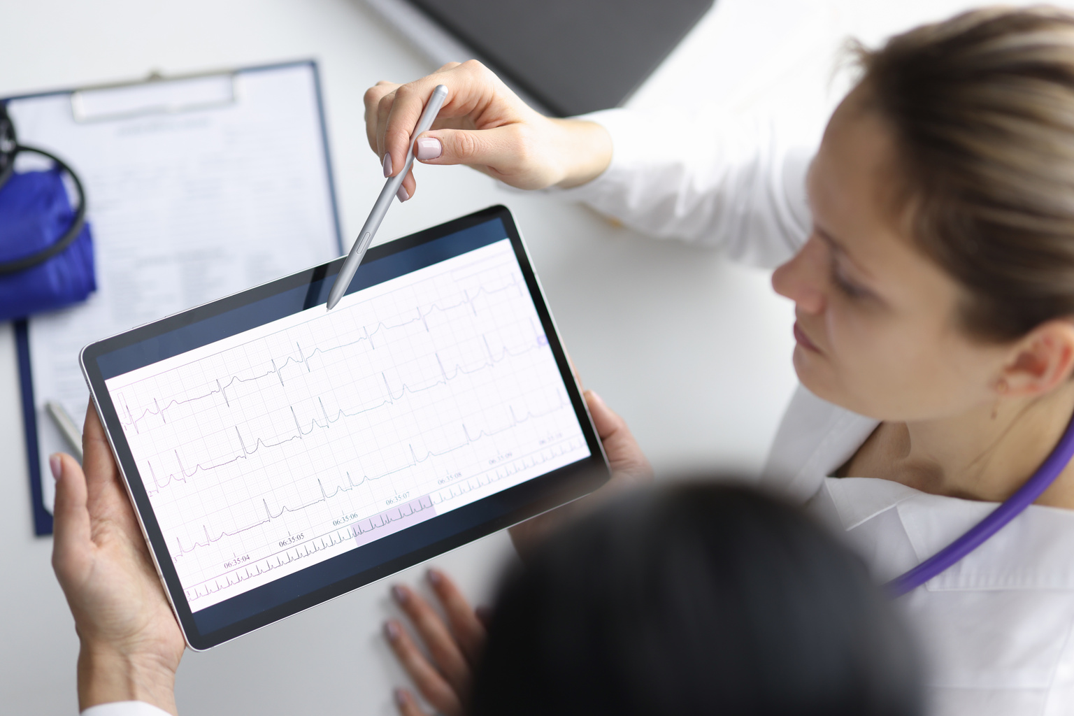 healthcare workers examine echocardiogram readout