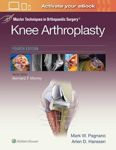 Master Techniques in Orthopaedic Surgery: Knee Arthroplasty book cover