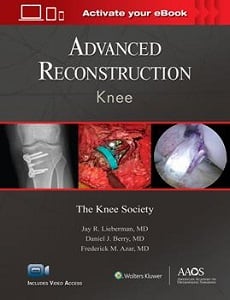 Advanced Reconstruction: Knee book cover