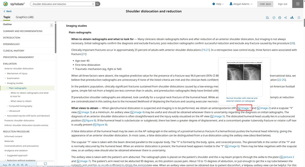 UpToDate shoulder dislocation graphic 3