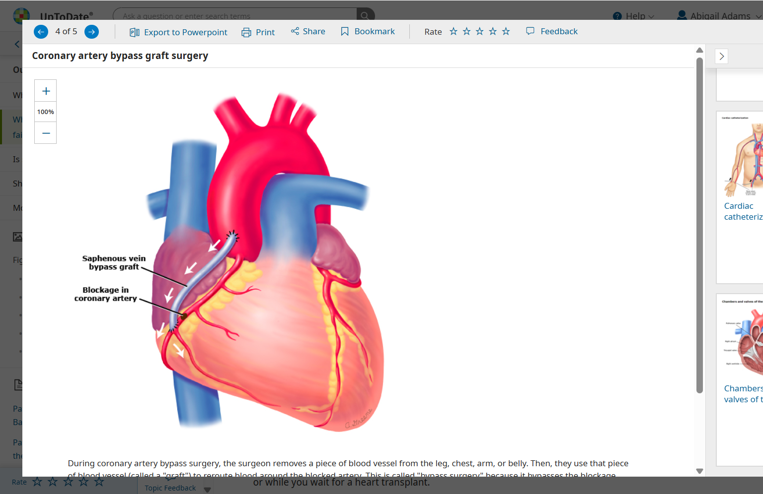 video screen - Patient Education