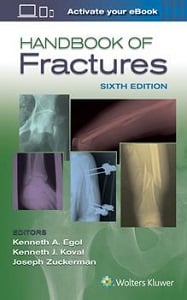 Handbook of Fractures book cover