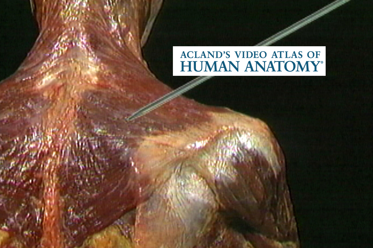 Illustration of shoulder muscles from Acland's video atlas of human anatomy