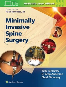 Minimally Invasive Spine Surgery book cover