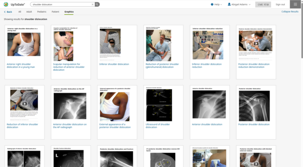 UpToDate Shoulder Dislocation Graphic