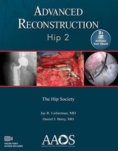 Advanced Reconstruction: Hip 2 book cover