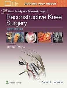 Master Techniques in Orthopaedic Surgery: Reconstructive Knee Surgery book cover