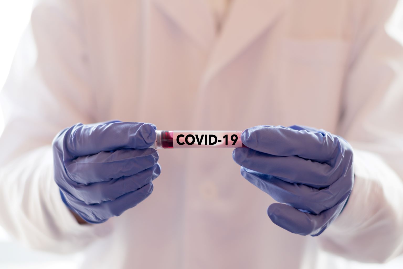COVID-19 Codes