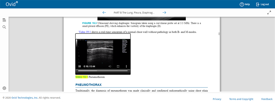 Screenshot of Ovid Journals Reader