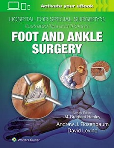 Hospital for Special Surgery's Illustrated Tips and Tricks in Foot and Ankle Surgery book cover