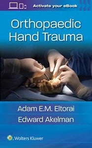 Orthopaedic Hand Trauma book cover