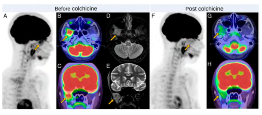 Clinical Nuclear Medicine
