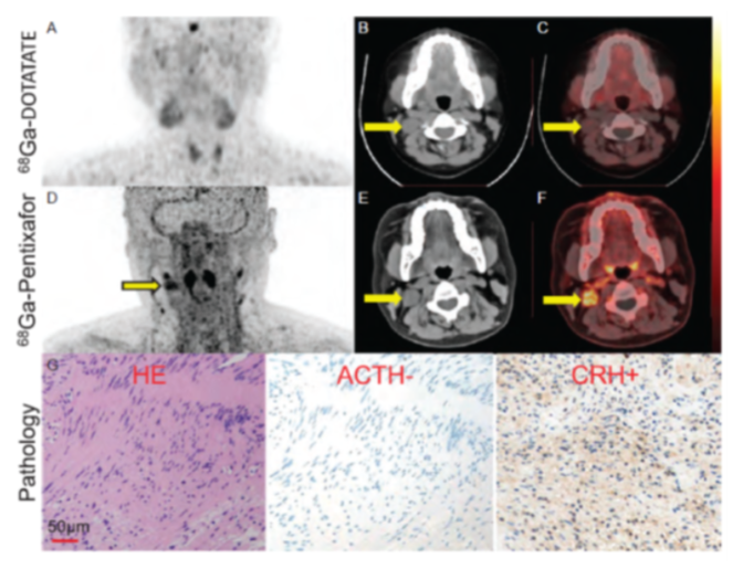 Clinical Nuclear Medicine